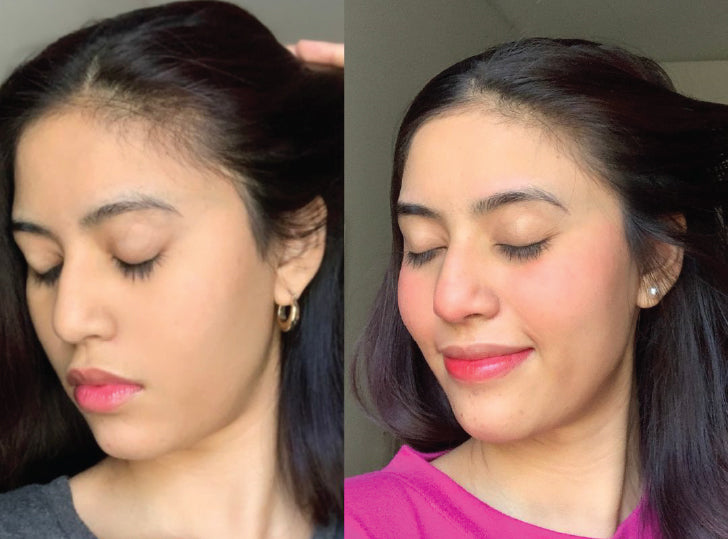 Hair Growth and Strengthening Treatment for Women