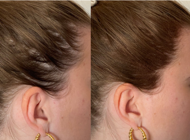 Hair Building Fibers KeraFiber