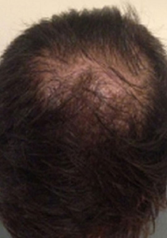 Hair Building Fibers KeraFiber